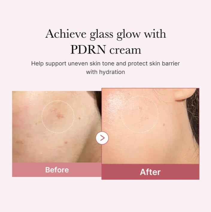 MEDICUBE PDRN Pink Hyaluronic Moisturizing Cream 50 ml /hidratálókrém - Image 3