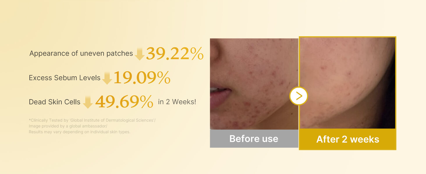 MEDICUBE Kojic Acid Turmeric Pad 70 pads - Image 7