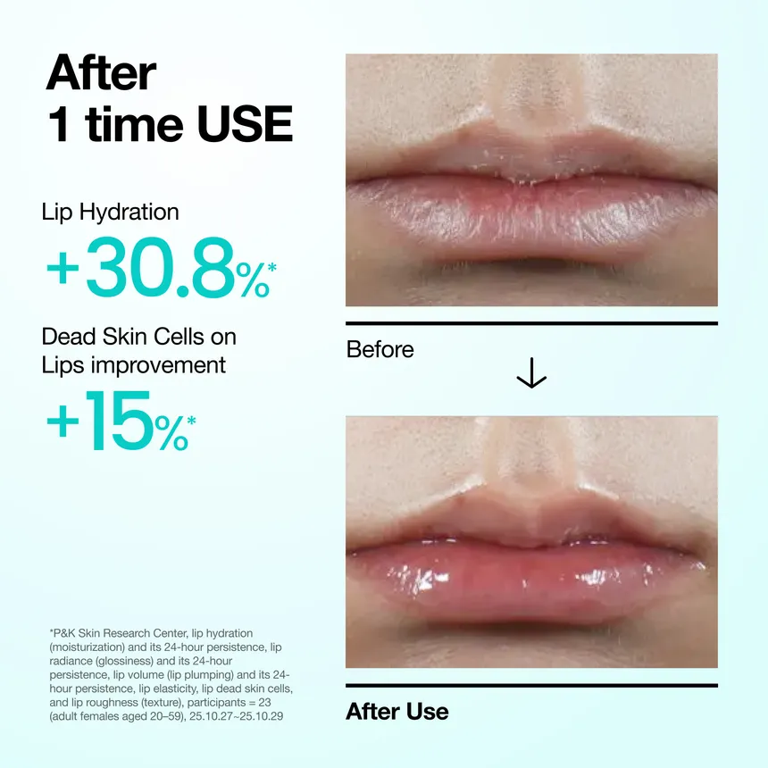 ANUA PDRN Lip Serum 10ml - Image 4